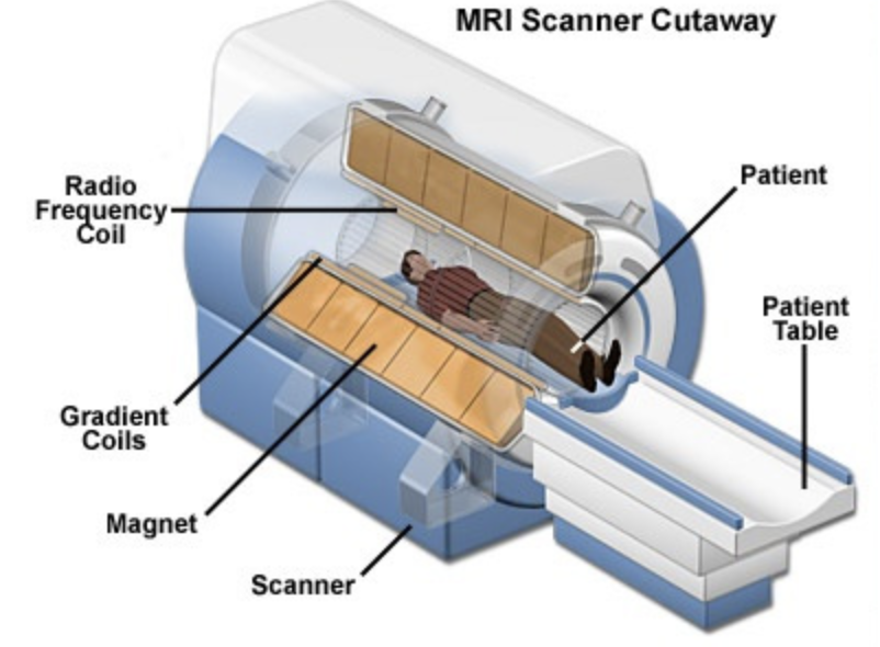 MRI Scanner